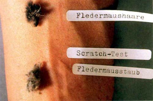 A moderate skin reaction to bat hairs and a strong reaction to bat dust.